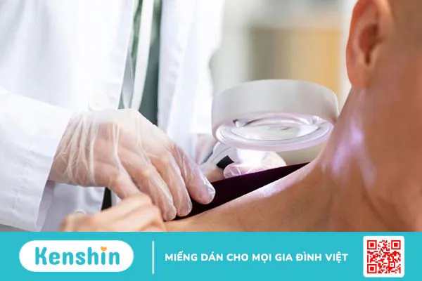 Mụn nước là gì? Cách điều trị hiệu quả 5