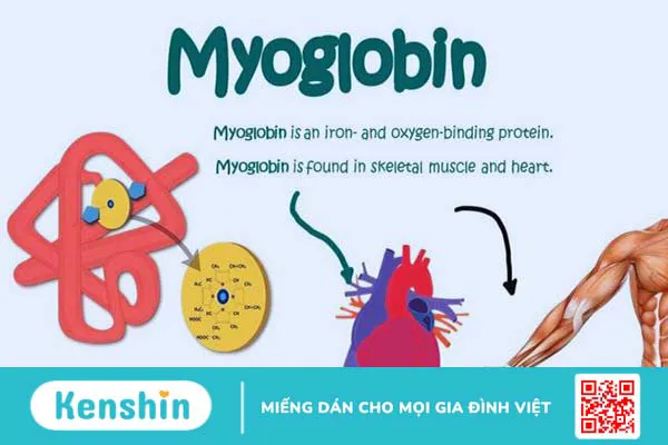 myoglobin-la-gi-xet-nghiem-myoglobin-de-chan-doan-van-de-tim-mach 1.webp