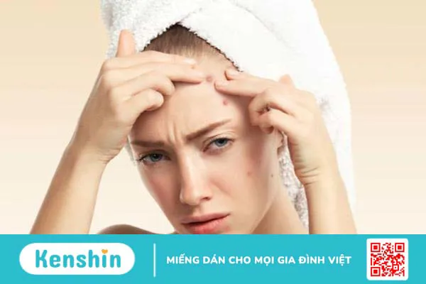 Nặn mụn có nên nặn hết máu không và cần lưu ý điều gì khi nặn mụn? 1