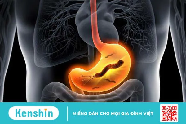 Đang nhiễm vi khuẩn HP dương tính có chữa được không - 3