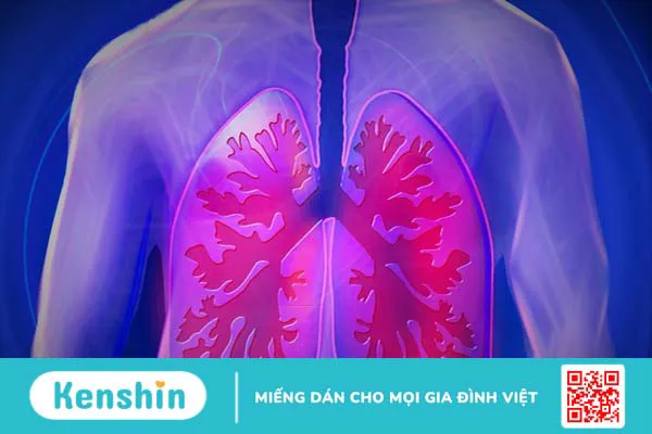 Những biến chứng COPD có thể gây ra là gì?1