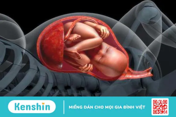 Những dấu hiệu của việc mẹ bị đa ối trong khi mang thai 1