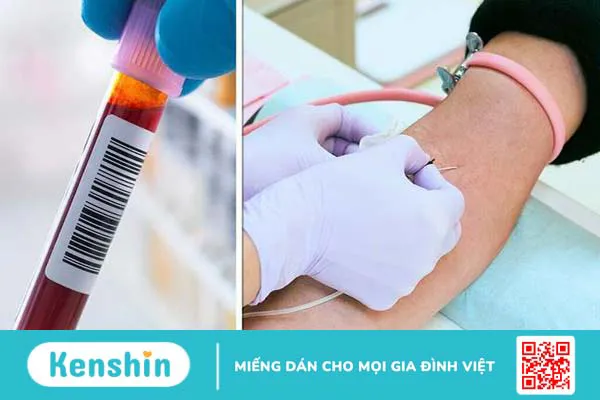 Những điều cần biết về sốc sản khoa và hướng xử trí khi sốc sản khoa 4