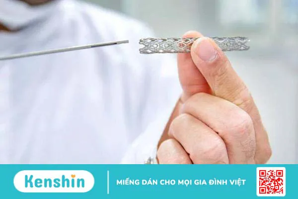 nhung-van-de-can-luu-y-doi-voi-benh-nhan-dat-stent-mach-vanh-1