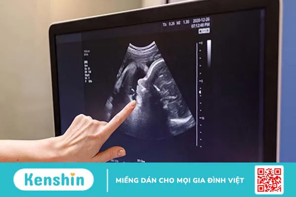 Siêu âm đo tình trạng lượng nước ối trung bình 2