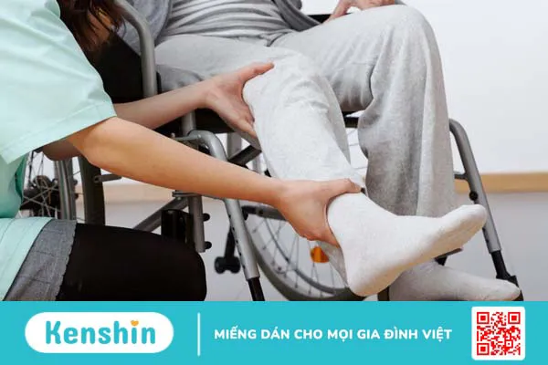 Phải làm gì khi bị rạn xương mác cẳng chân? 3