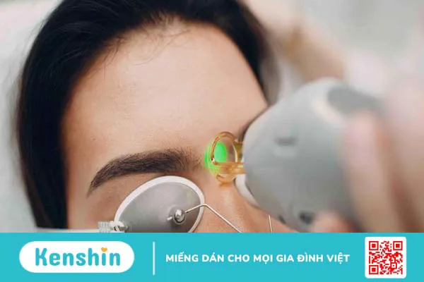 Quy trình xóa chân mày bằng laser như thế nào? Có đau không? 1