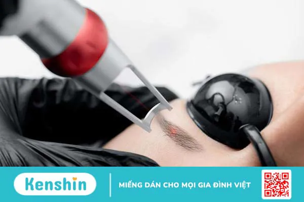 Quy trình xóa chân mày bằng laser như thế nào? Có đau không? 3