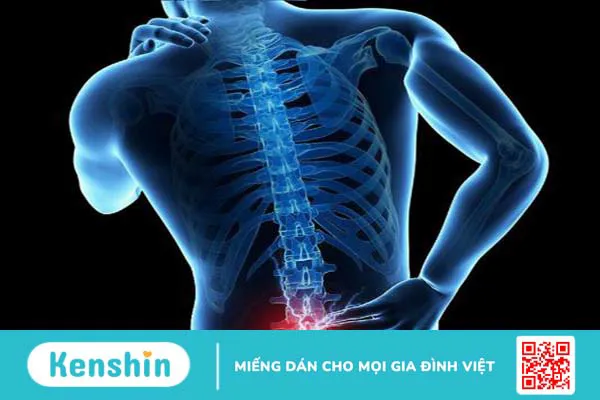 Rễ thần kinh tủy sống là gì? Dấu hiệu và cách điều trị bệnh