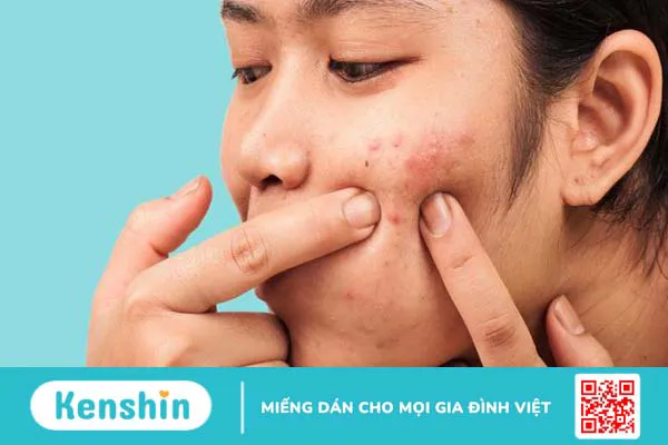 Sau khi nặn mụn có nên rửa mặt bằng nước muối không? -1