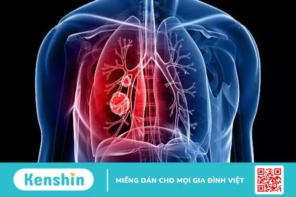 Scanneuron uống trước hay sau ăn? Những điều cần biết 4