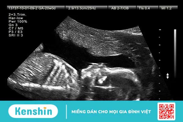 Giải đáp: Siêu âm 2d cân nặng có chuẩn không? 1