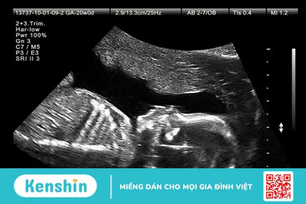 Siêu âm 2D và 4D cái nào chính xác hơn? Siêu âm 2D và 4D khác nhau thế nào? 1