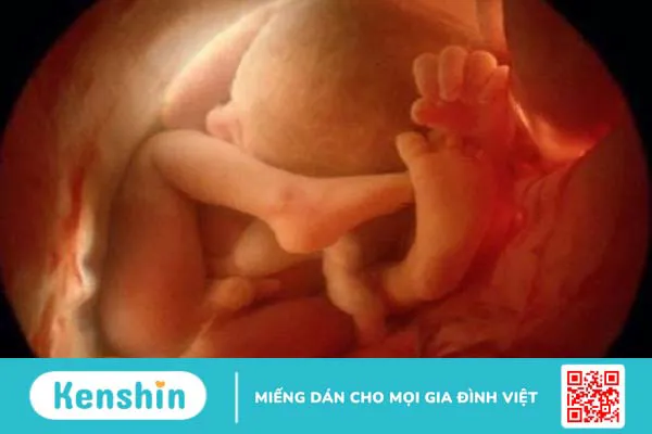 Siêu âm 2D và 4D cái nào chính xác hơn? Siêu âm 2D và 4D khác nhau thế nào? 2