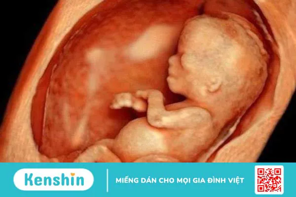 Mẹ bầu thường quan tâm siêu âm 4D nhiều có tốt không? 3