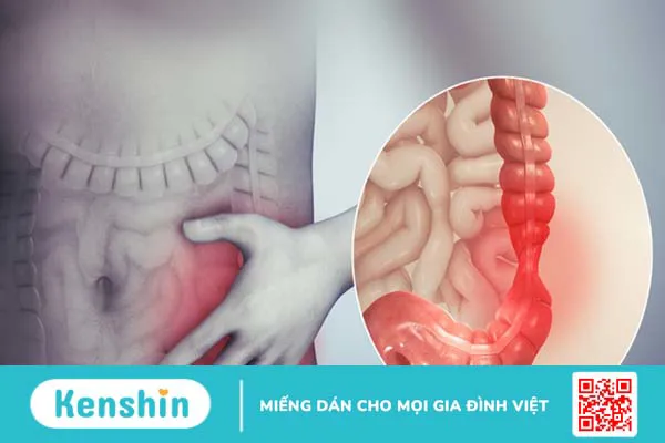 Stress kích hoạt hội chứng ruột kích thích: Không thể chủ quan! 2