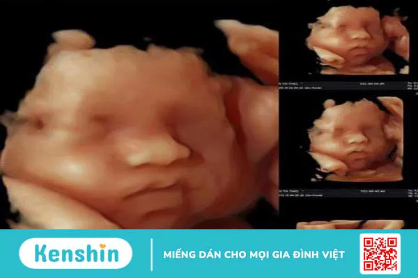 Sự khác nhau giữa siêu âm 2D 3D 4D 5D là như thế nào? 4