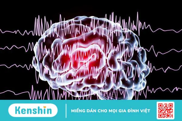 Tác hại của bệnh động kinh đối với từng cơ quan và sức khỏe tổng thể của người bệnh 1