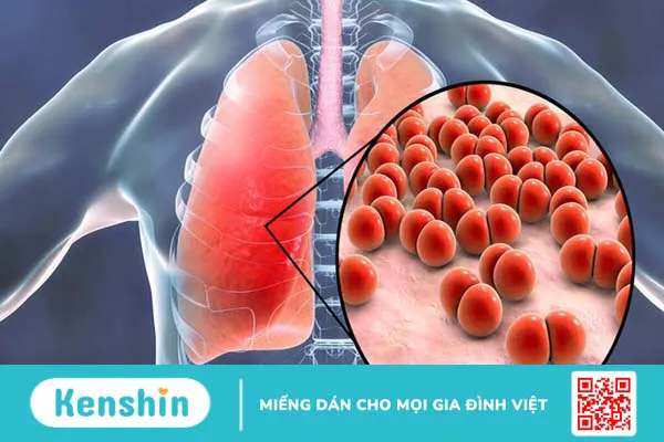 Tác hại của bệnh động kinh đối với từng cơ quan và sức khỏe tổng thể của người bệnh 3