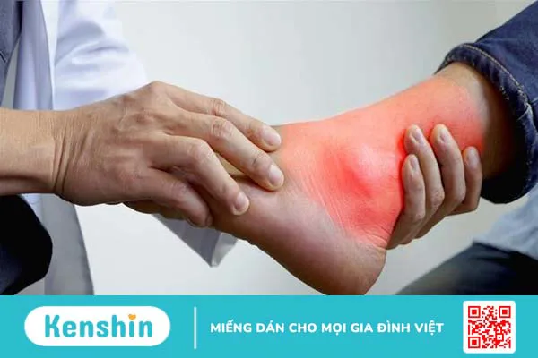 Phong tê thấp Bà Giằng uống bao lâu thì khỏi bệnh? Thuốc có thật sự tốt không? 3