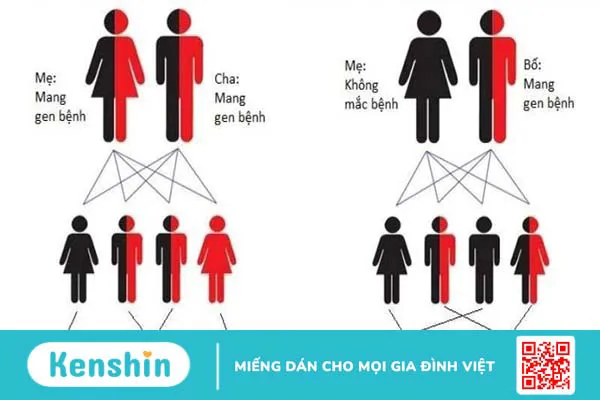 thalassemia-di-truyen-la-benh-gi-thalassemia-co-chua-tri-duoc-khong 2