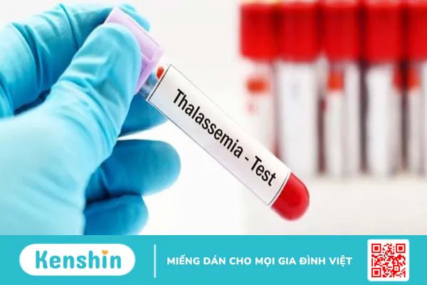 thalassemia-di-truyen-la-benh-gi-thalassemia-co-chua-tri-duoc-khong 3