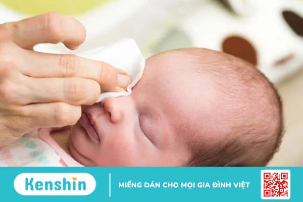 Thuốc nhỏ mắt Efticol dùng cho trẻ sơ sinh có an toàn không? Cần lưu ý gì khi sử dụng? 4