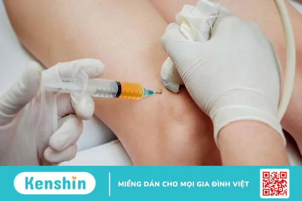 Tiêm corticoid áp dụng cho những vị trí nào? 3