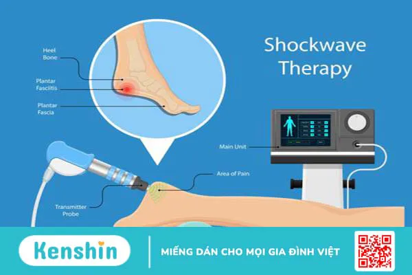 Tìm hiểu về sóng xung kích shockwave và ứng dụng trong y học 1