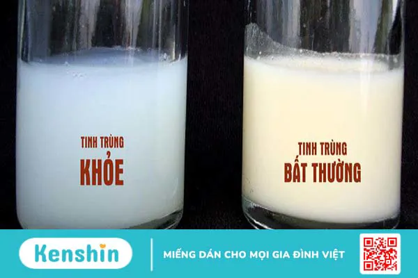 Tinh trùng màu trắng sữa là như thế nào