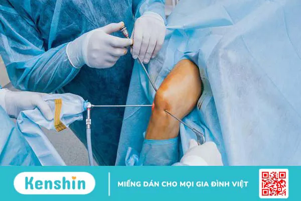 U sụn màng hoạt dịch: Chẩn đoán và chữa trị bệnh 3