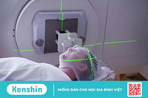 Ung thư thực quản di căn gan: Dấu hiệu và cách điều trị 2