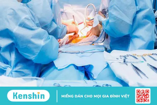 Ung thư thực quản di căn gan: Dấu hiệu và cách điều trị 4