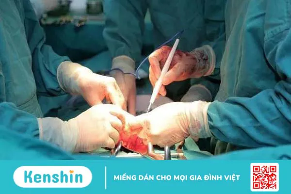 Ung thư thực quản di căn xương: Dấu hiệu, nguyên nhân và cách điều trị 3