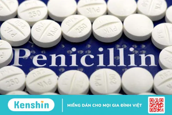 Viêm da liên cầu là gì? Nguyên nhân, triệu chứng và cách điều trị 4