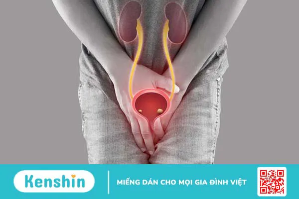 Viêm niệu đạo nữ có tự khỏi không? Điều trị như thế nào? 1