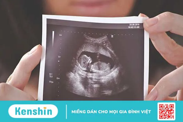 Xét nghiệm bầu 12 tuần có cần nhịn ăn không? 2