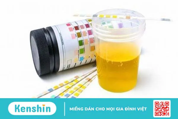 Xét nghiệm bầu 12 tuần có cần nhịn ăn không? 3