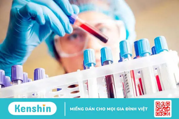 Xét nghiệm NK là gì? Những điều cần biết 2