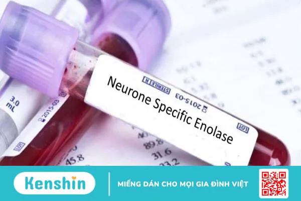 Xét nghiệm NSE là gì? Những điều cần biết 2