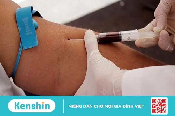 Xét nghiệm NSE là gì? Những điều cần biết 3