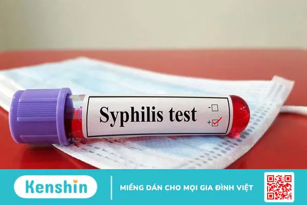 Xét nghiệm syphilis – Phương pháp sàng lọc bệnh giang mai hiệu quả 3