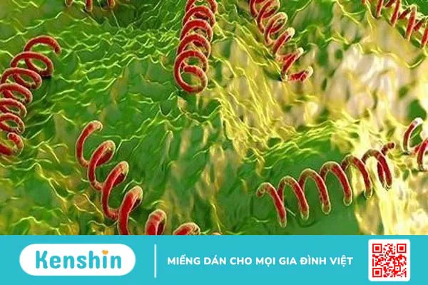 Xét nghiệm TPHA trong chẩn đoán bệnh giang mai 1