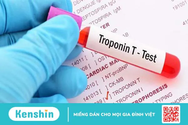 Xét nghiệm troponin – Phương pháp chẩn đoán nhồi máu cơ tim 3