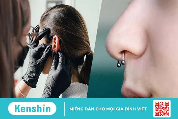 Xỏ khuyên có được ăn tôm không? Nên tránh ăn gì để vết thương mau lành? 1