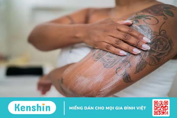 Xóa xăm bằng laser là gì? Có để lại sẹo không? 3